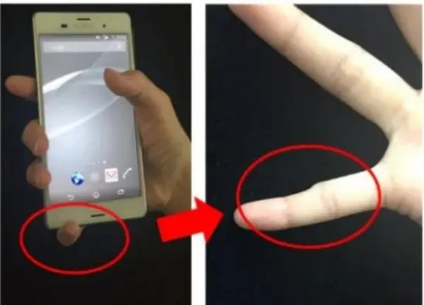 Smartphone Pinky Finger Treatment: Relieve Strain with PinkyPillow